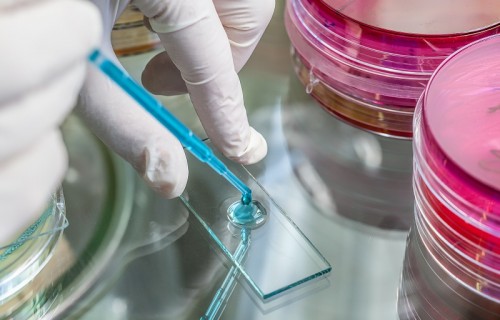 Pipette and the specimen examinating in laboratory